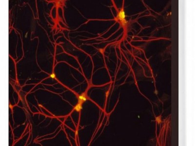 Wat zijn de gevaren van fluoride voor de hersenen?